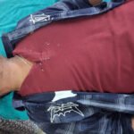 मतदान के लिए जा रहे छात्र को रोका, गुस्से में कर्मचारी के सिर पर मारी बोतल